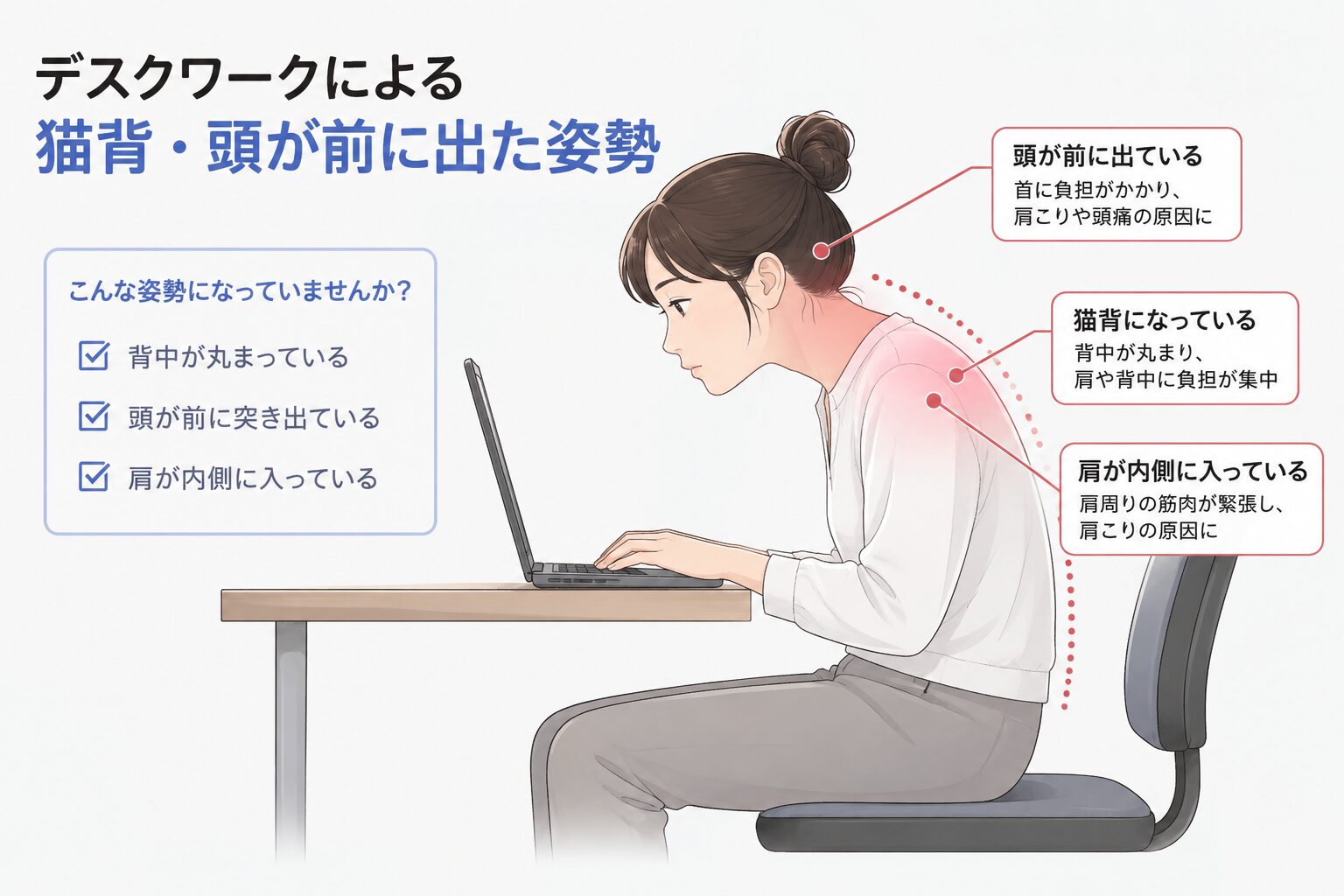 肩こりにつながる猫背や姿勢の崩れ