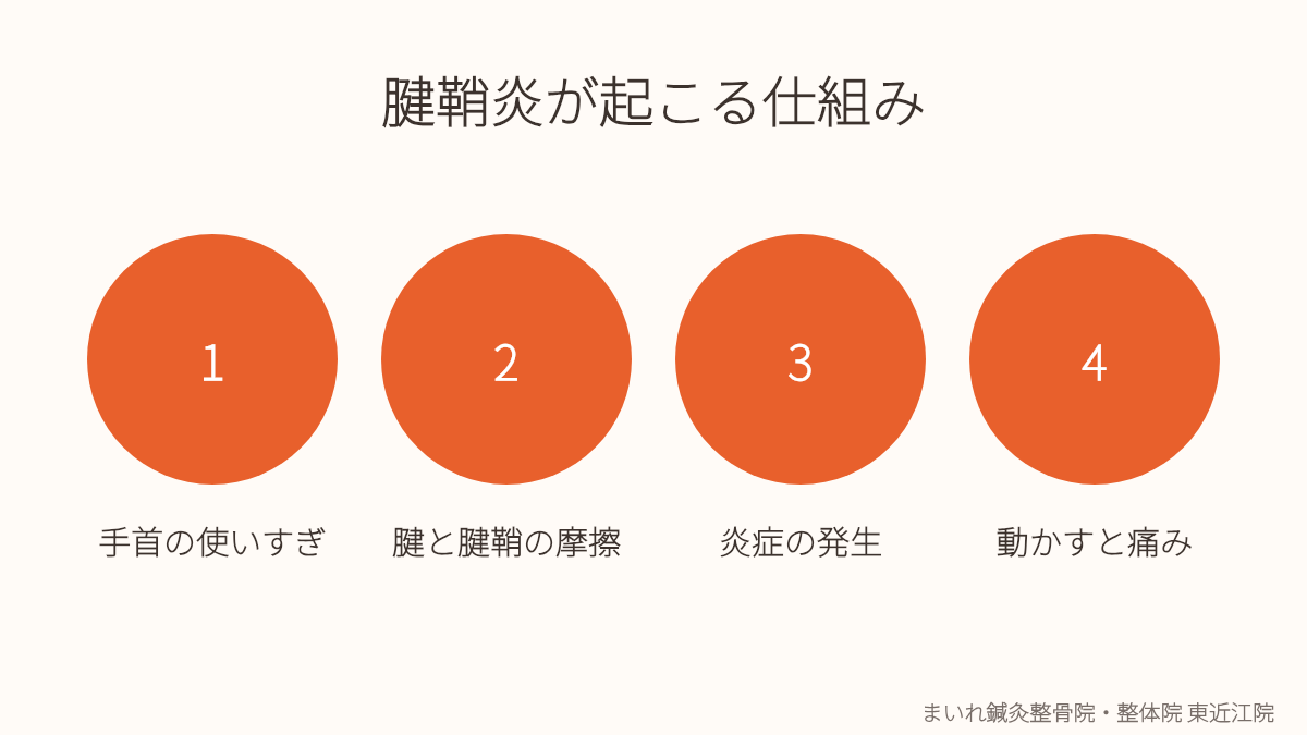 東近江市で腱鞘炎・手首の痛みが起こる仕組みを示すイラスト