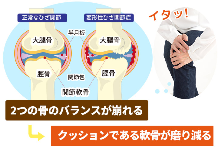 2つの骨のバランスが崩れる