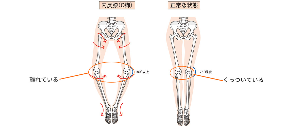 膝痛はなぜ起こるの？