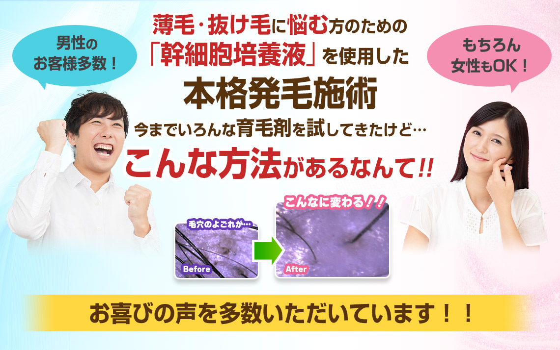 薄毛・抜け毛に悩む方のための「幹細胞培養液」を使用した本格発毛施術