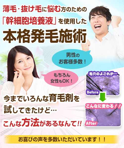 薄毛・抜け毛に悩む方のための「幹細胞培養液」を使用した本格発毛施術